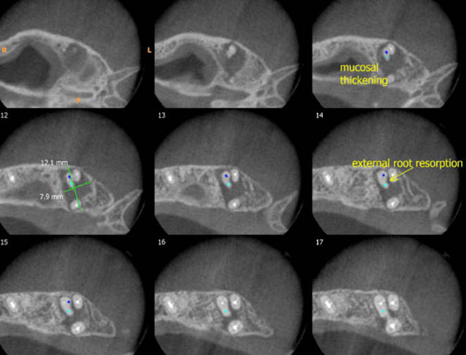 provide professional cbct radiology reporting