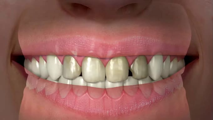 create 3d dental visuals and academic animations