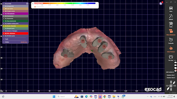 design full arch all on x prosthesis