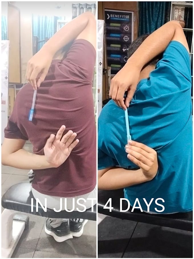 provide a professional tech neck posture correction plan