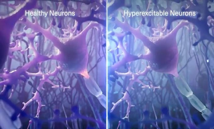 create professional 3d medical animation videos and cgi medical explainers