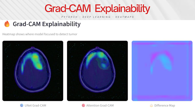 add gradcam explainability and visualization to your pytorch model