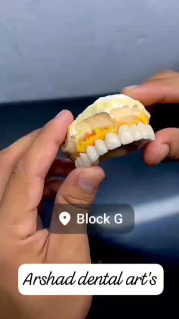 design zirconia bridge and crowns using exocad