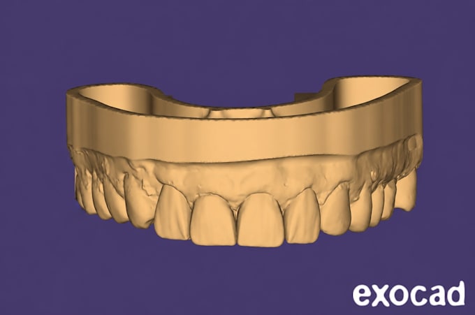 do professional dental cad design using exocad
