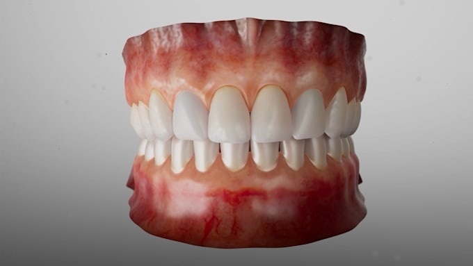 create 3d medical animation for surgery, 3d medical explainer video