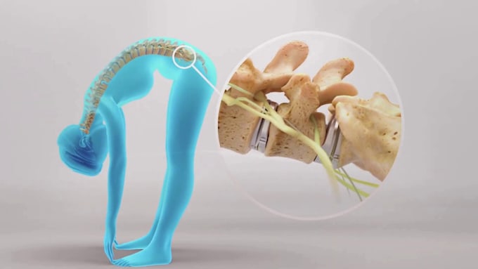 create 3d medical animation surgical procedure orthopedic medical device video