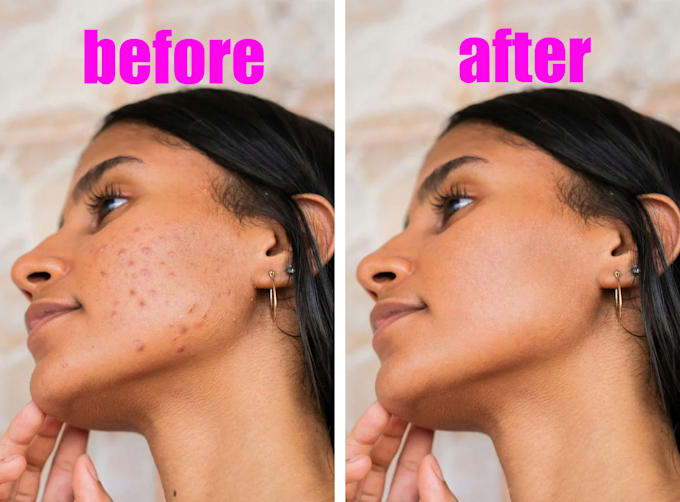 remove pimples and small tattoos from photos