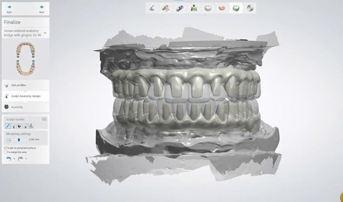 design dental cad restorations using exocad and 3shape