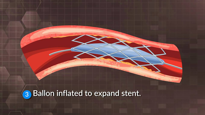 create medical 2d animation video animated video healthcare services