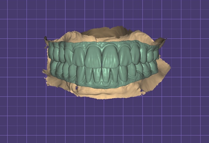 professional exocad dental cad design