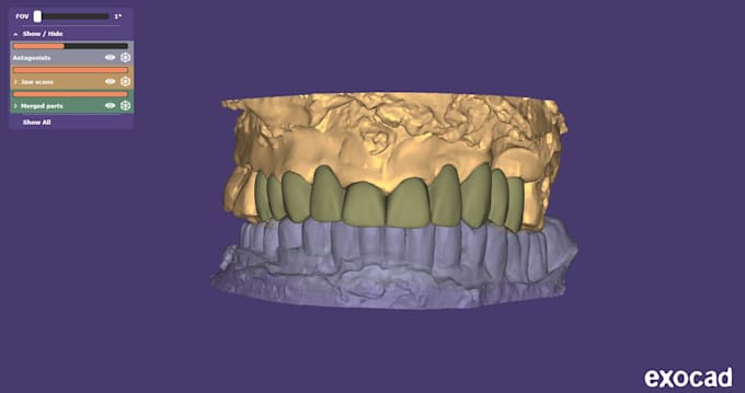do precise dental cad cam designing for crowns and partial dentures