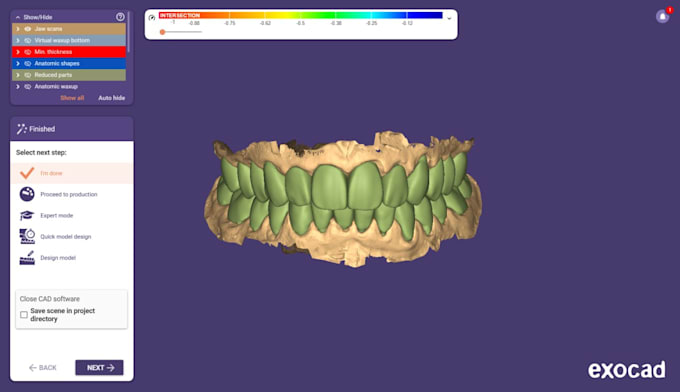 design precise exocad dental crowns, bridges and veneers