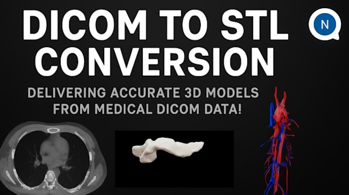 convert dicom to stl for medical 3d printing