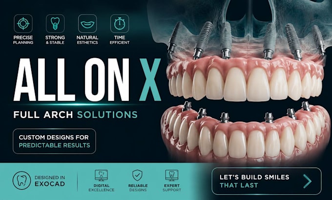 do professional all on x and full arch dental cases on exocad