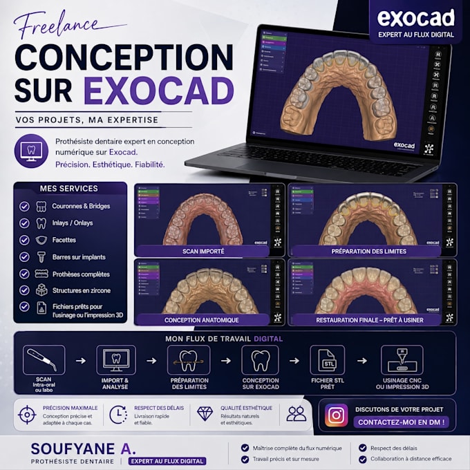 create professional dental cad designs with exocad