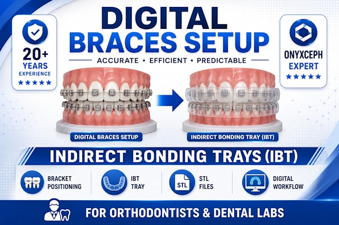 design digital braces setup and indirect bonding trays