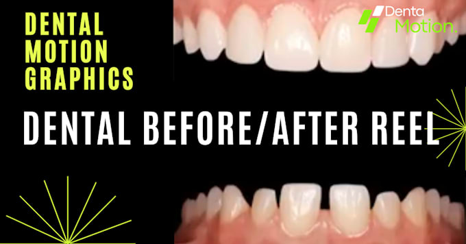 create professional dental before after reel with motion graphics