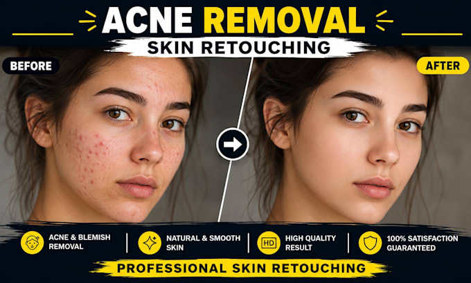 remove pimples, acne, scars and skin blemishes