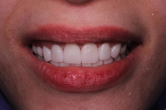create 3d dental animation and medical motion graphics