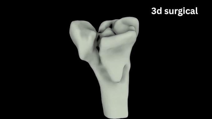 create 3d medical animation, surgical animation, surgery animation video