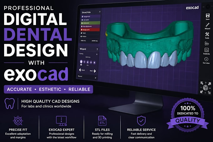 design dental crowns and bridges in exocad