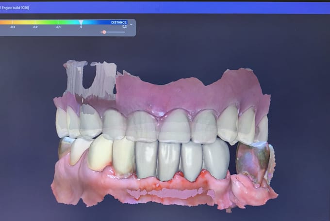 design crowns, bridges and implants professionally in exocad