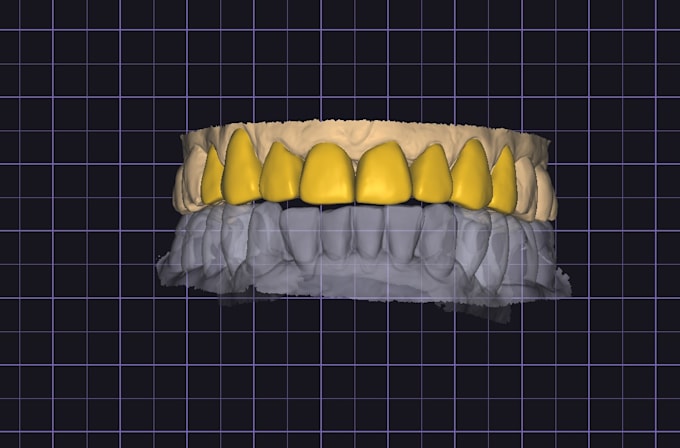 design custom exocad anterior smile makeovers and full arch restorations