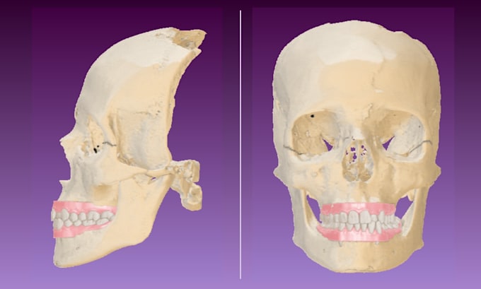 do dental cbct dicom segmentation and stl conversion