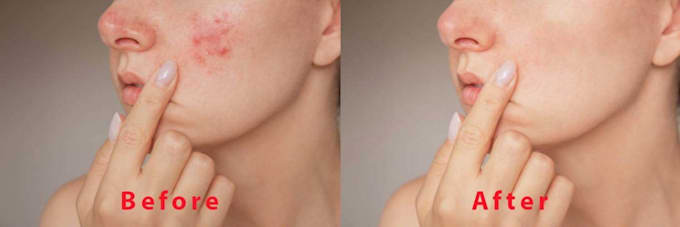 remove background and use image retouching