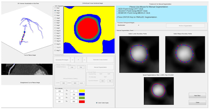 do image and object classification using matlab, python
