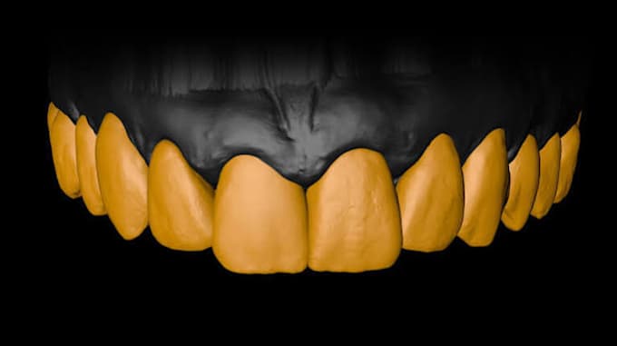 do precise dental cad design using exocad and blender