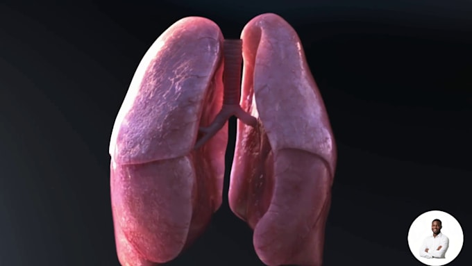 do 3d medical explainer video, 3d medical animation