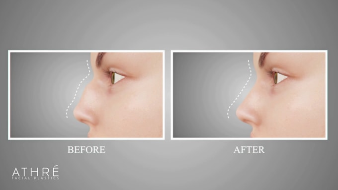 create realistic 3d medical animation, surgical procedure, anatomy visualization