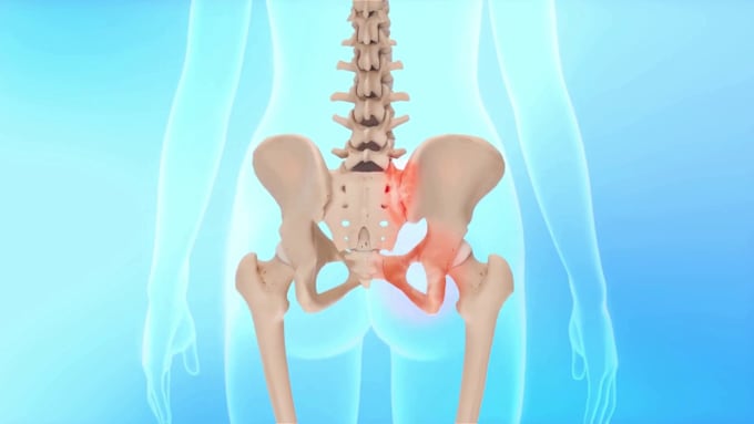 create 3d medical device and surgical implant animation