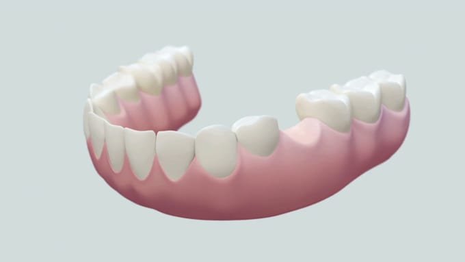 create 3d medical animation dental video dental surgery procedure visualization