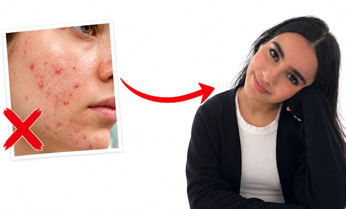 be your personal skincare coach for acne prone skin