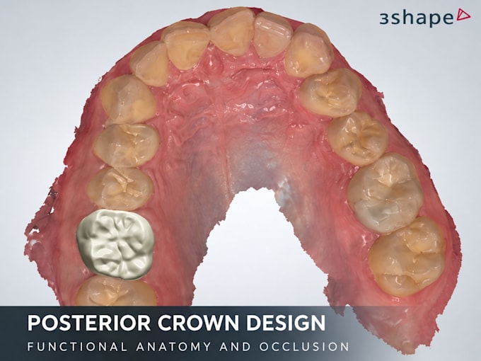 design anterior and posterior dental crowns using 3shape