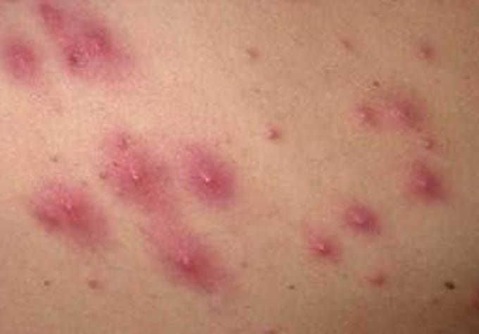 skin diseases treatment