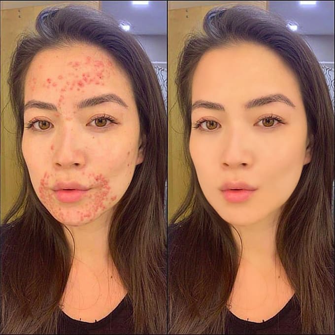 touch up your photo