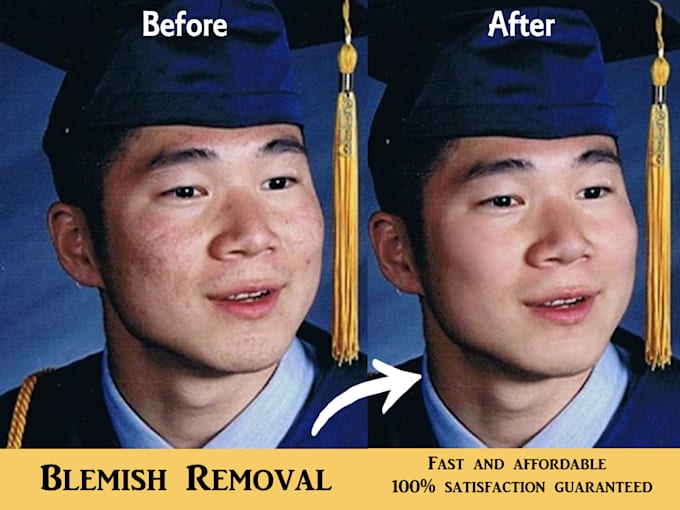 remove acne and scars from your photos