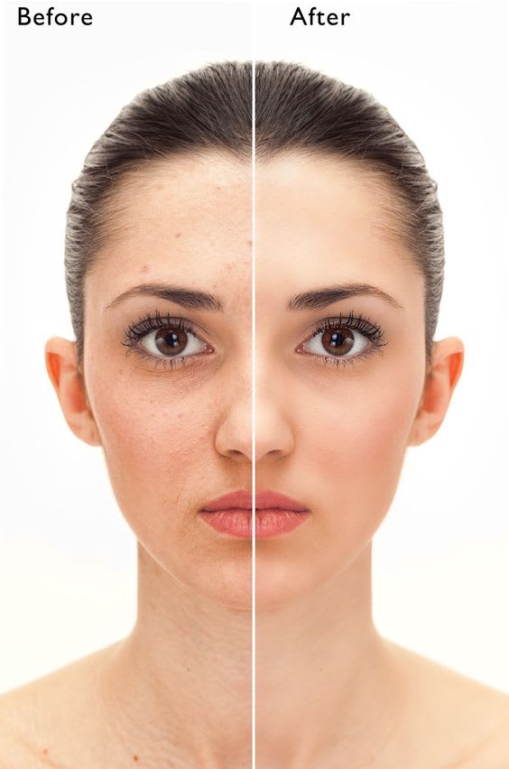do professional skin retouching