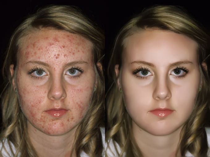 do model photo editing and retouching