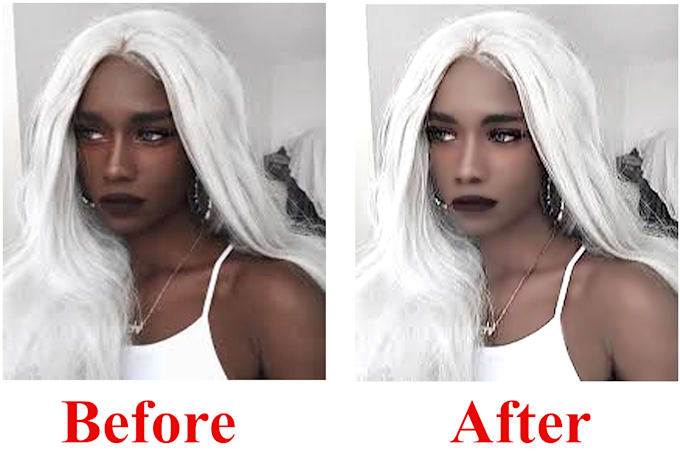 remove dark spots on face, damage, pox scars etc