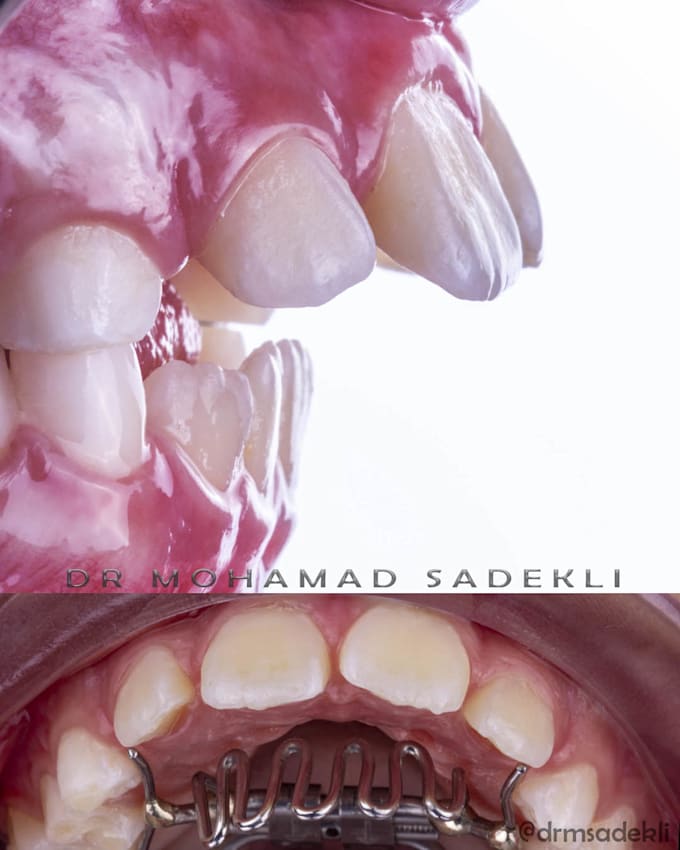 refine cosmetic or dental photos to make great posts