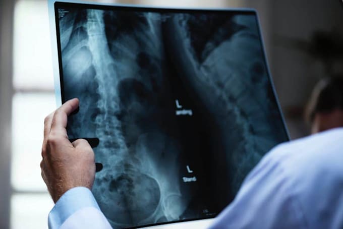 expert opinion as a radiologist on xray mri ct scan