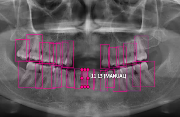 do image annotation, segmentaion, labeling