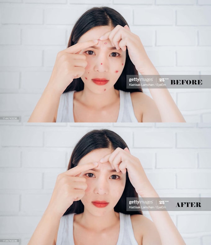 remove wrinkles,  blemishes, spots, pimples from face