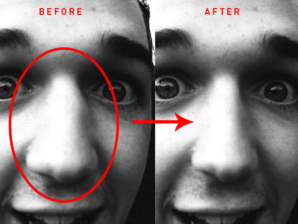 do a photoshop plastic surgery