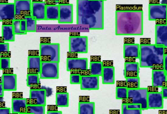 do precise data and image annotation, labelling and tagging