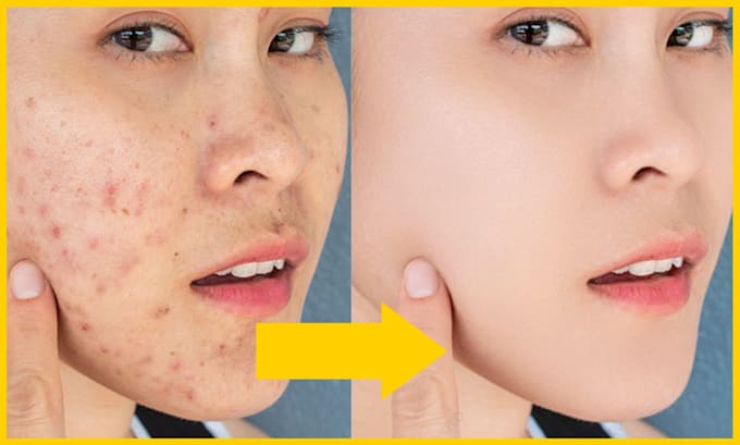 do high end skin retouching, photoshop retouch, wedding photo retouching